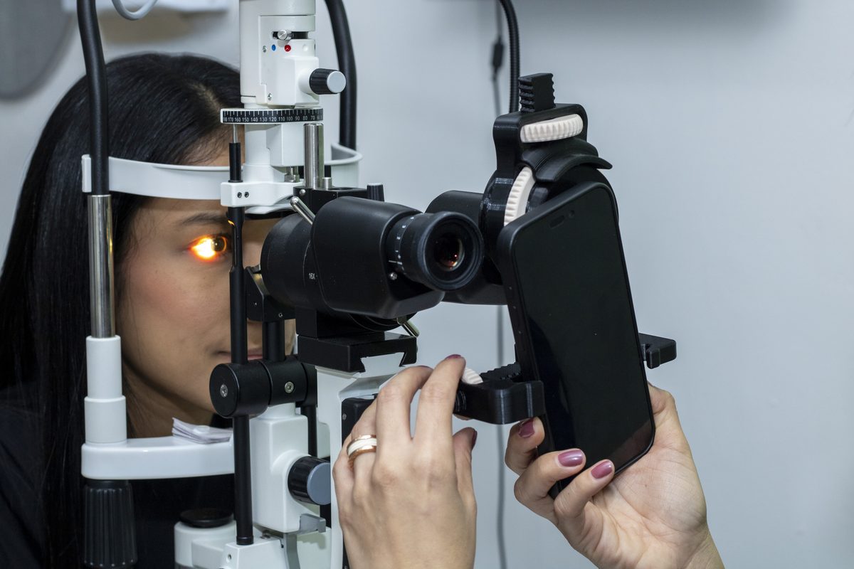 Ojo iluminado por la lámpara de hendidura durante la evaluación de la superficie ocular
